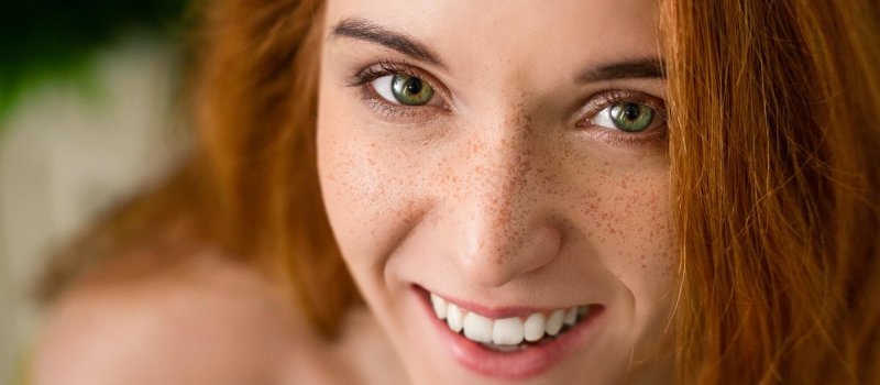 Cheerful redhead woman with freckles laughing at camera